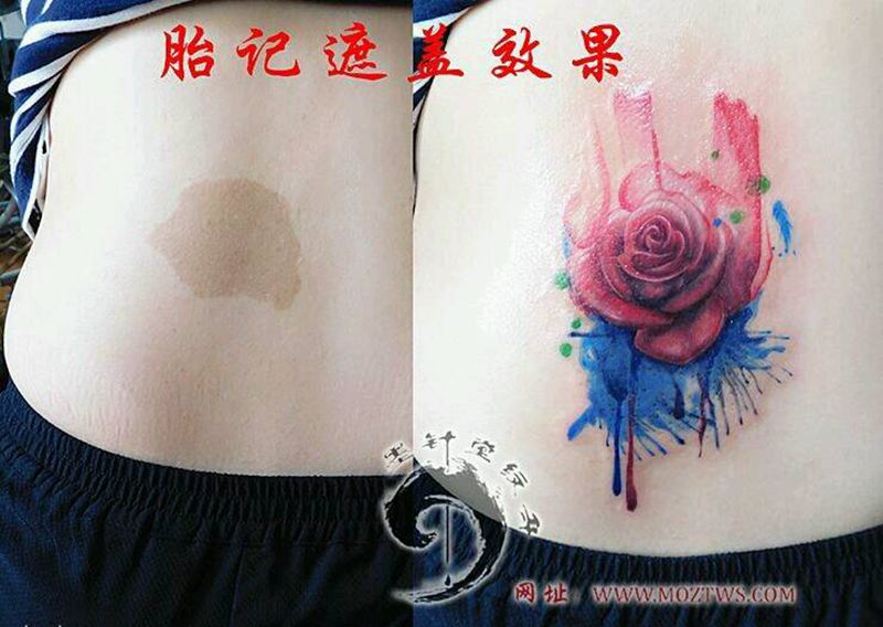 胎记遮盖纹身图片