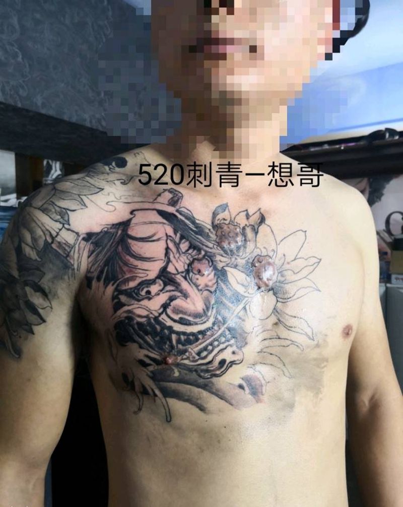 半甲伤疤覆盖纹身图片