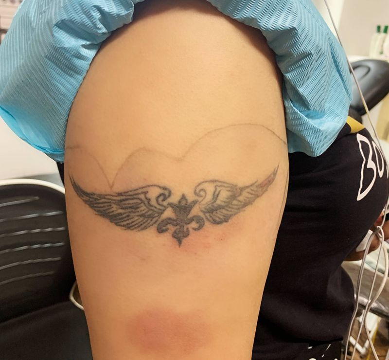 遮盖水彩鲸鱼纹身图片_手臂水彩遮盖水彩鲸鱼纹身图案