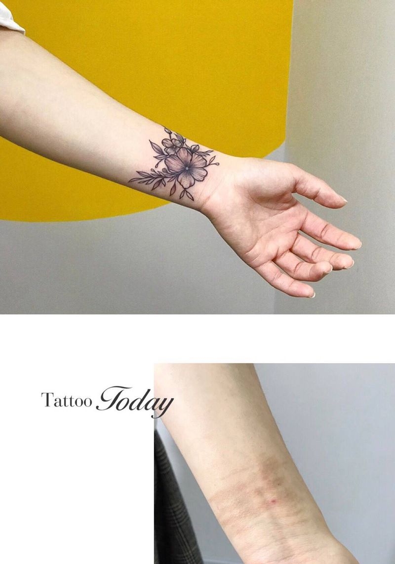 疤痕遮盖纹身图片_手臂手部花草遮盖疤痕纹身图案