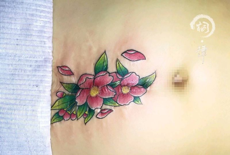 剖腹产遮盖纹身图片