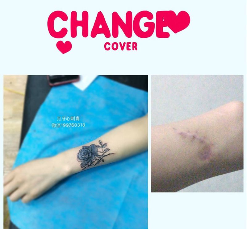 疤痕遮盖纹身图片_成品手臂清新植物花疤痕遮盖纹身图案