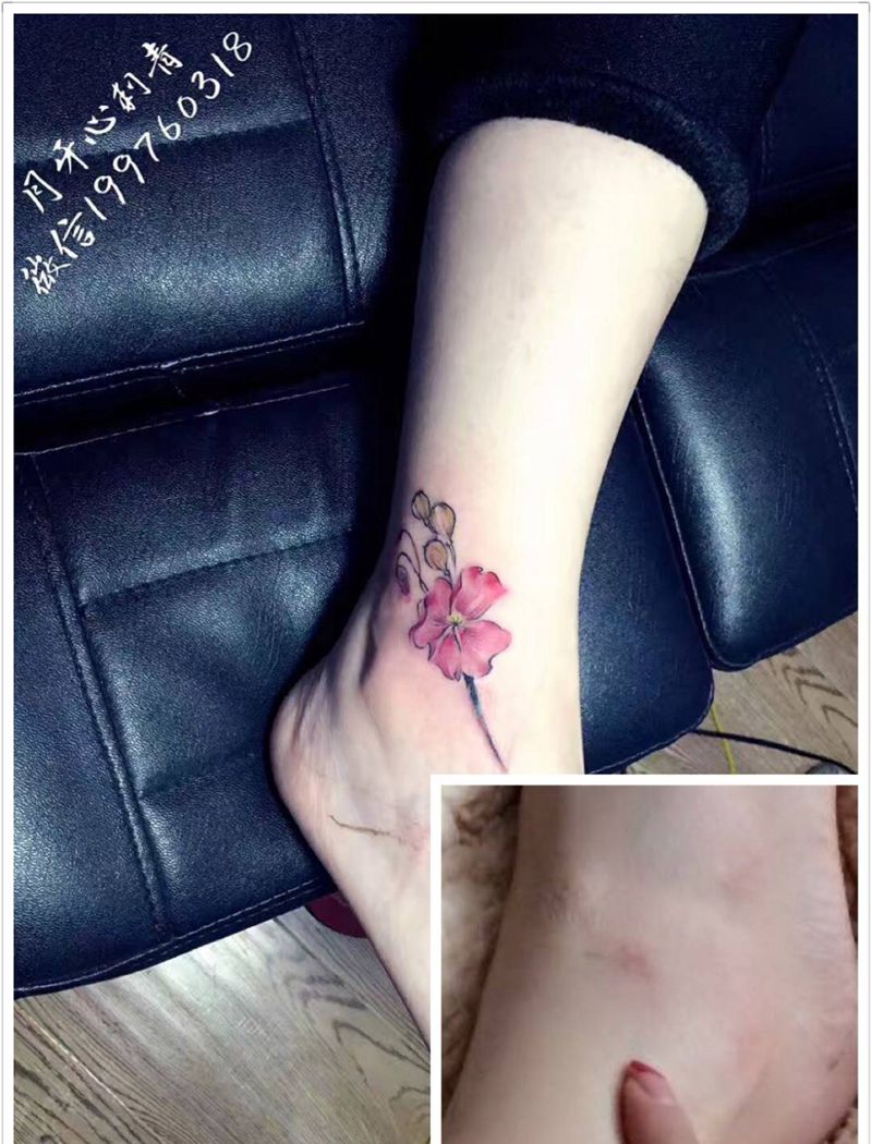 罂粟花遮盖疤痕纹身图片_成品脚部腿部清新植物疤痕遮盖彩色纹身图案