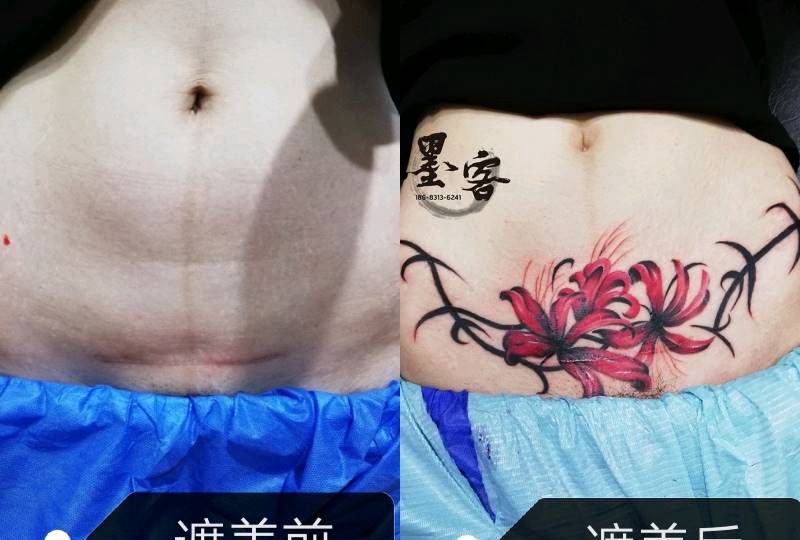 刨腹产遮盖纹身图片_腹部纹身图案