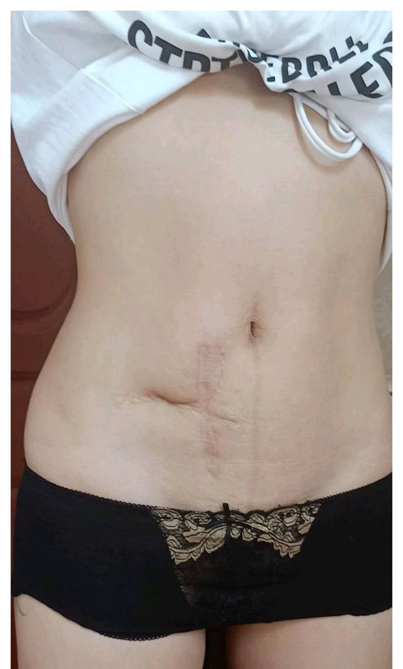 疤痕暴力遮盖纹身图片