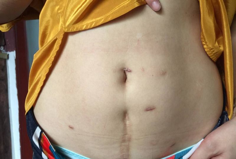 罂粟花 遮盖疤痕纹身图片_成品腹部传统清新国画植物字符原创静物纹身图案