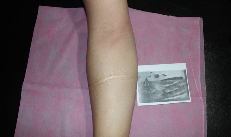 大海帆船浪遮盖疤痕纹身图片_手臂点刺水墨风景海浪纹身图案