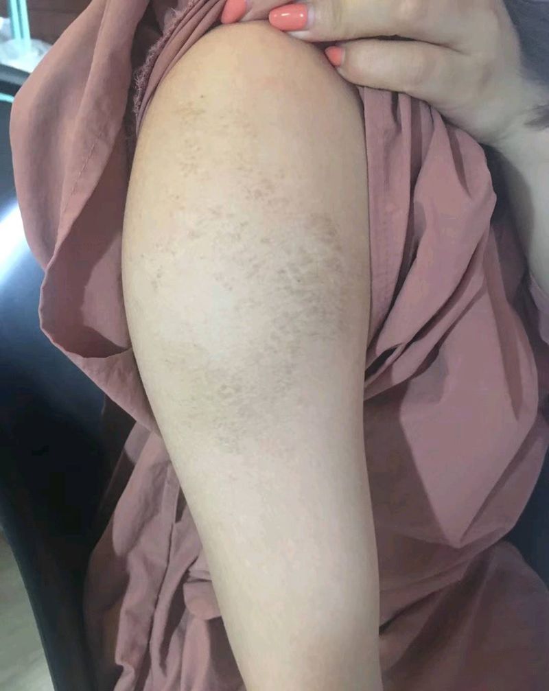 大臂疤痕遮盖纹身图片