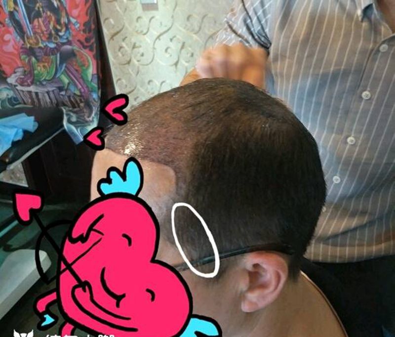 头皮纹身 发际线纹身 假发纹身纹身图片_腹部手臂手部肖像写实几何静物鬼神纹身图案