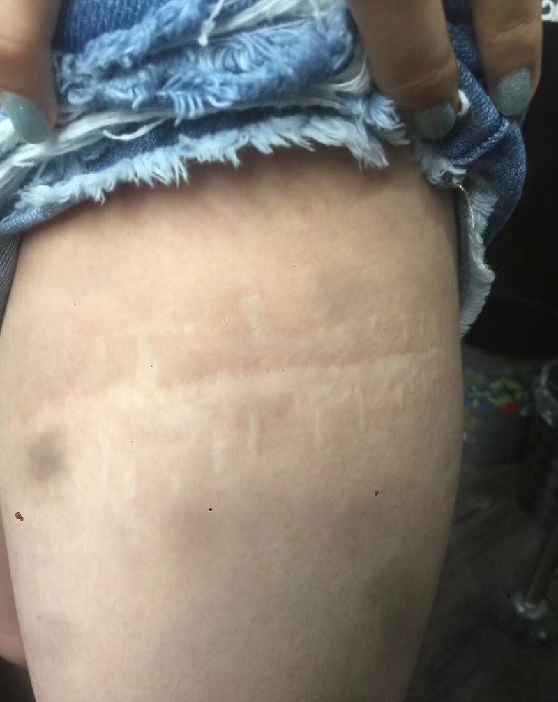 小海豚盖疤纹身图片