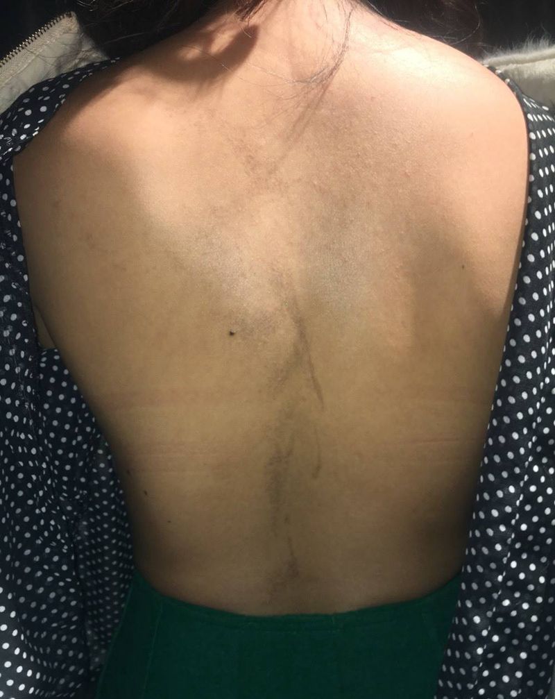 遮盖疤印纹身图片