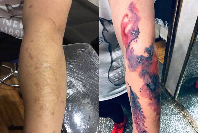 疤痕遮盖，星空