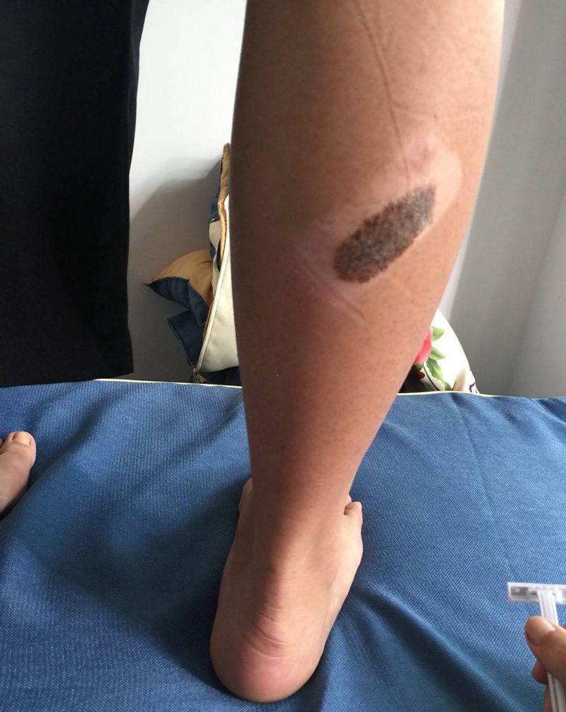 遮盖胎记纹身图片_成品腿部清新动物纹身图案