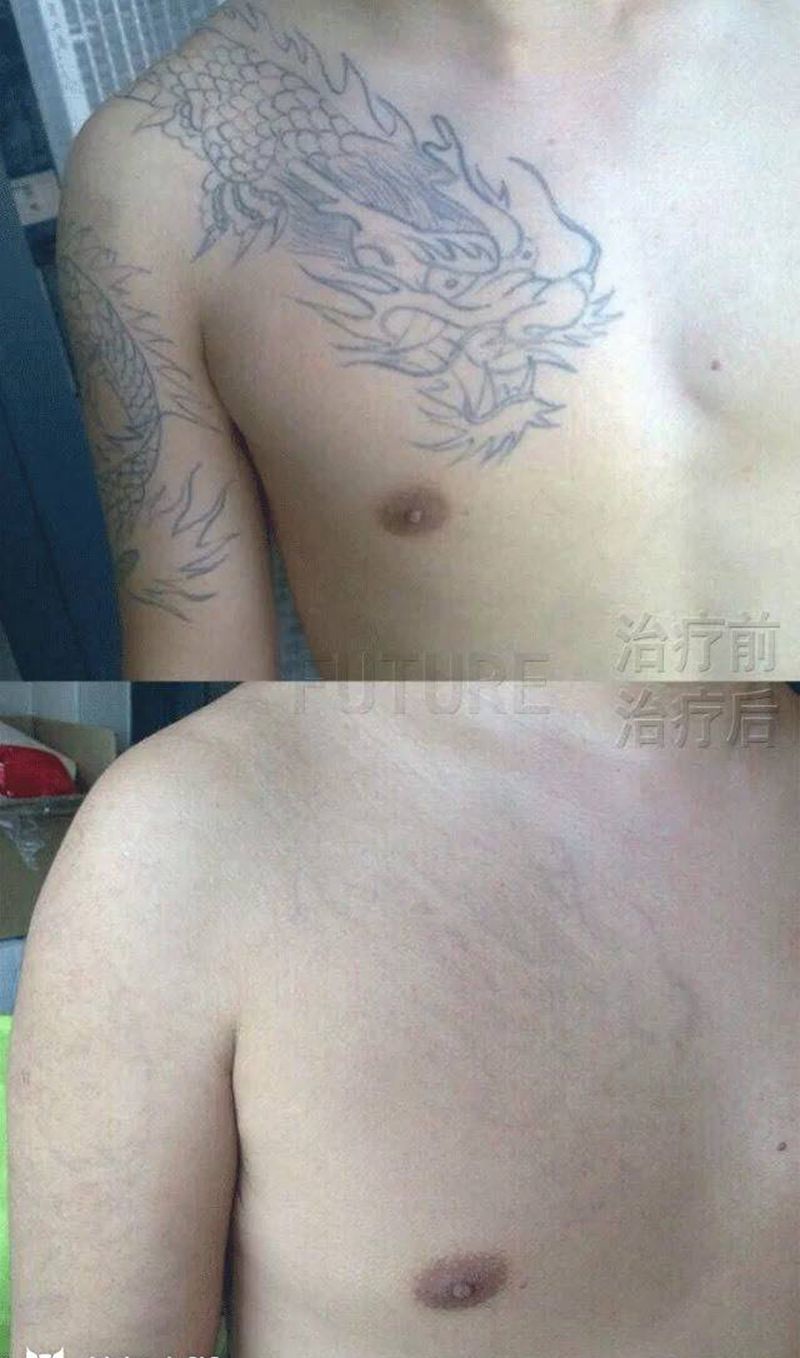 洗纹身纹身图片