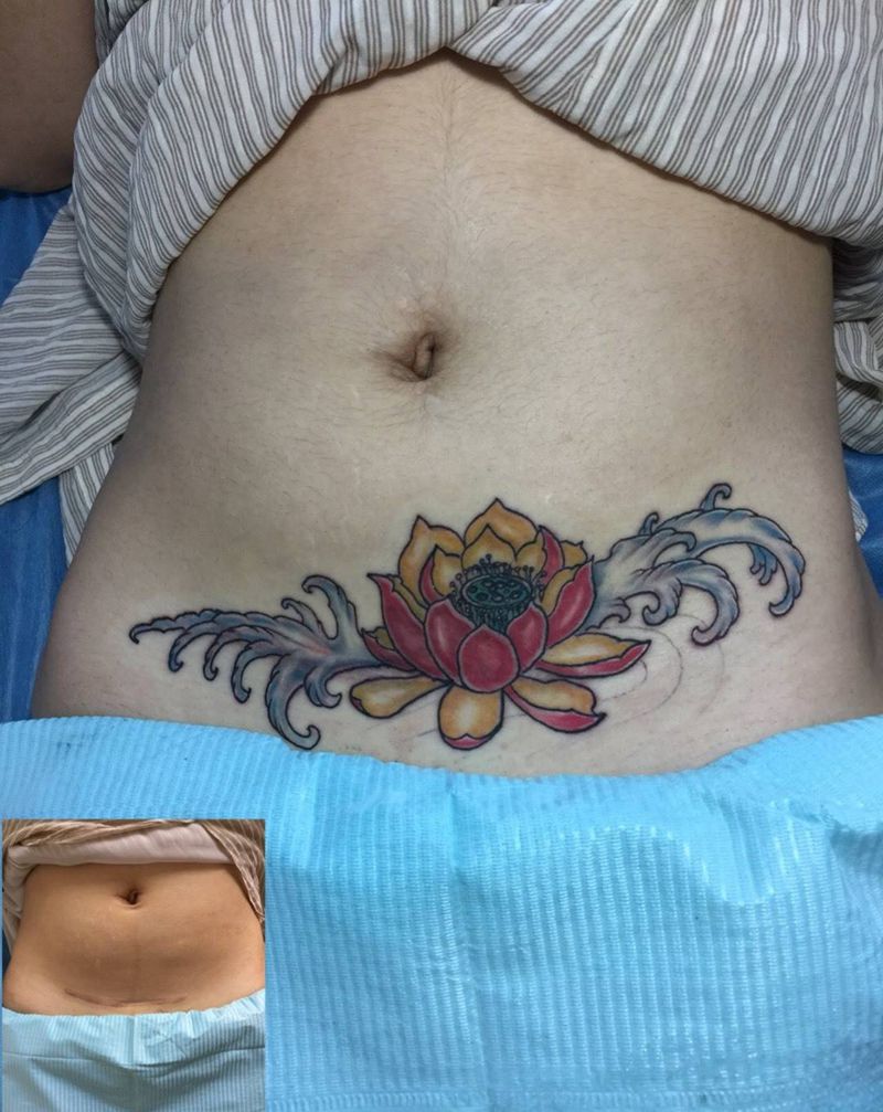 遮盖疤痕纹身图片_成品腹部传统原创纹身图案