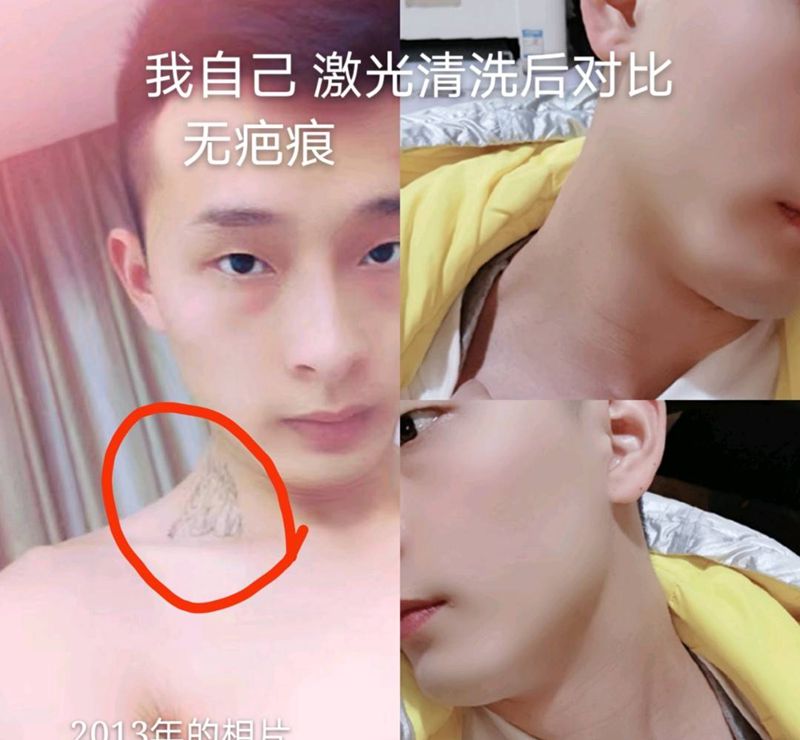 洗纹身纹身图片_全身皮秒纹身图案