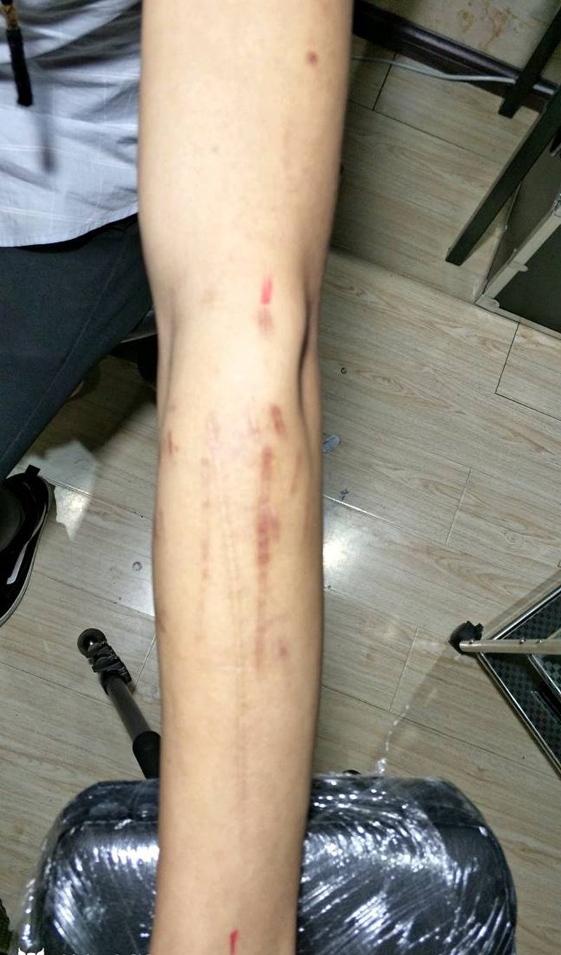 牡丹 遮盖 伤疤纹身图片_手臂新传统纹身图案