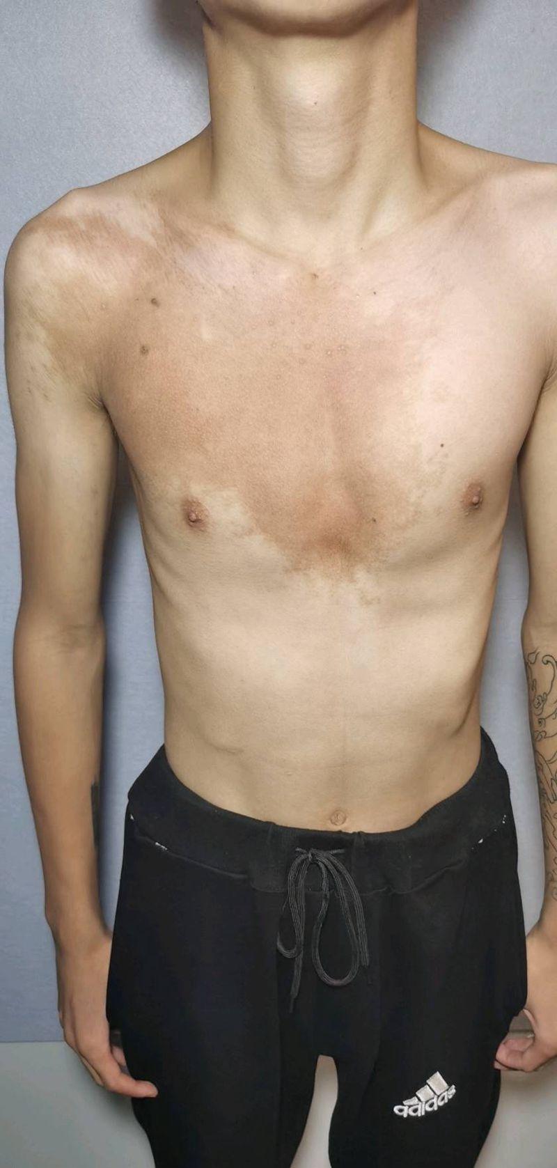 两面佛  花胸  线条遮盖胎记纹身图片_胸部纹身图案