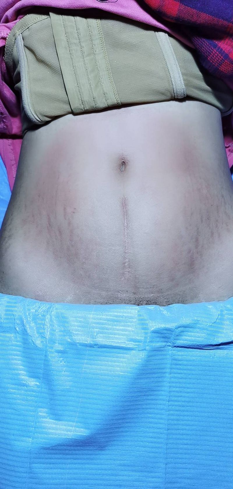 遮盖  疤痕纹身图片_腹部几何纹身图案