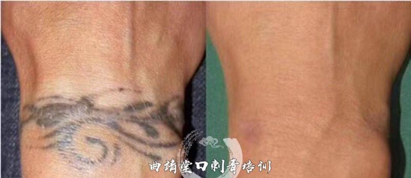 清洗纹身不留疤痕纹身图片