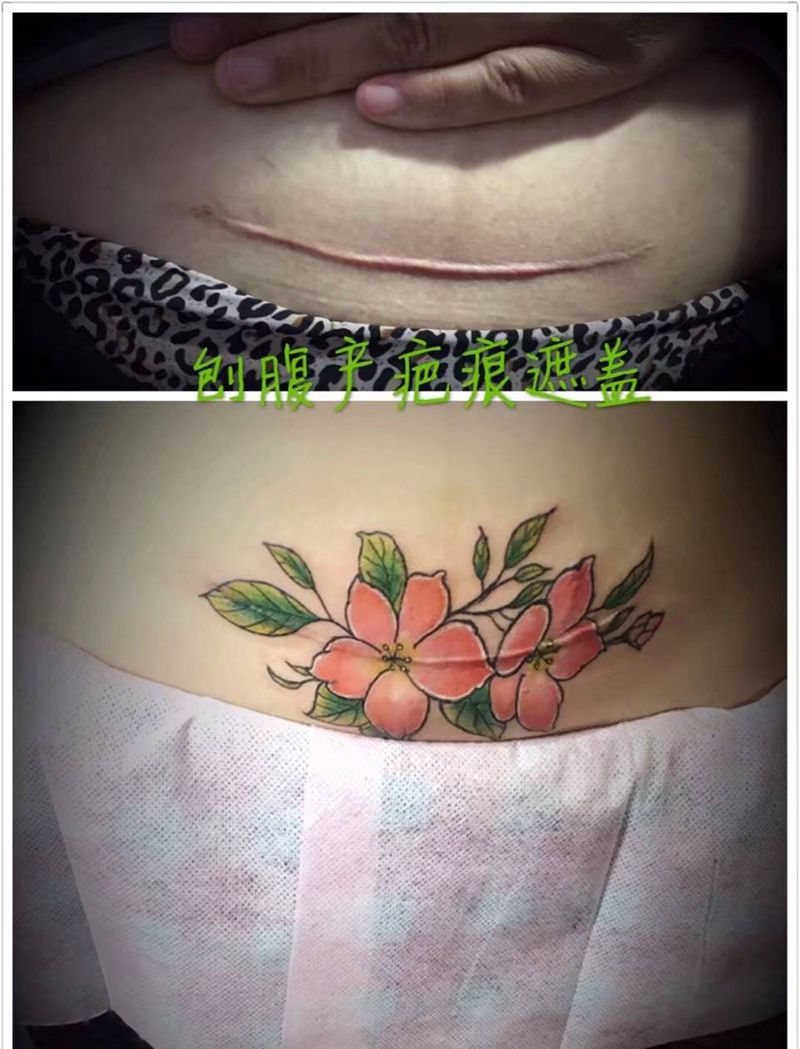刨腹产疤痕遮盖纹身图片
