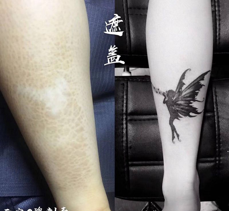 遮盖纹身图片