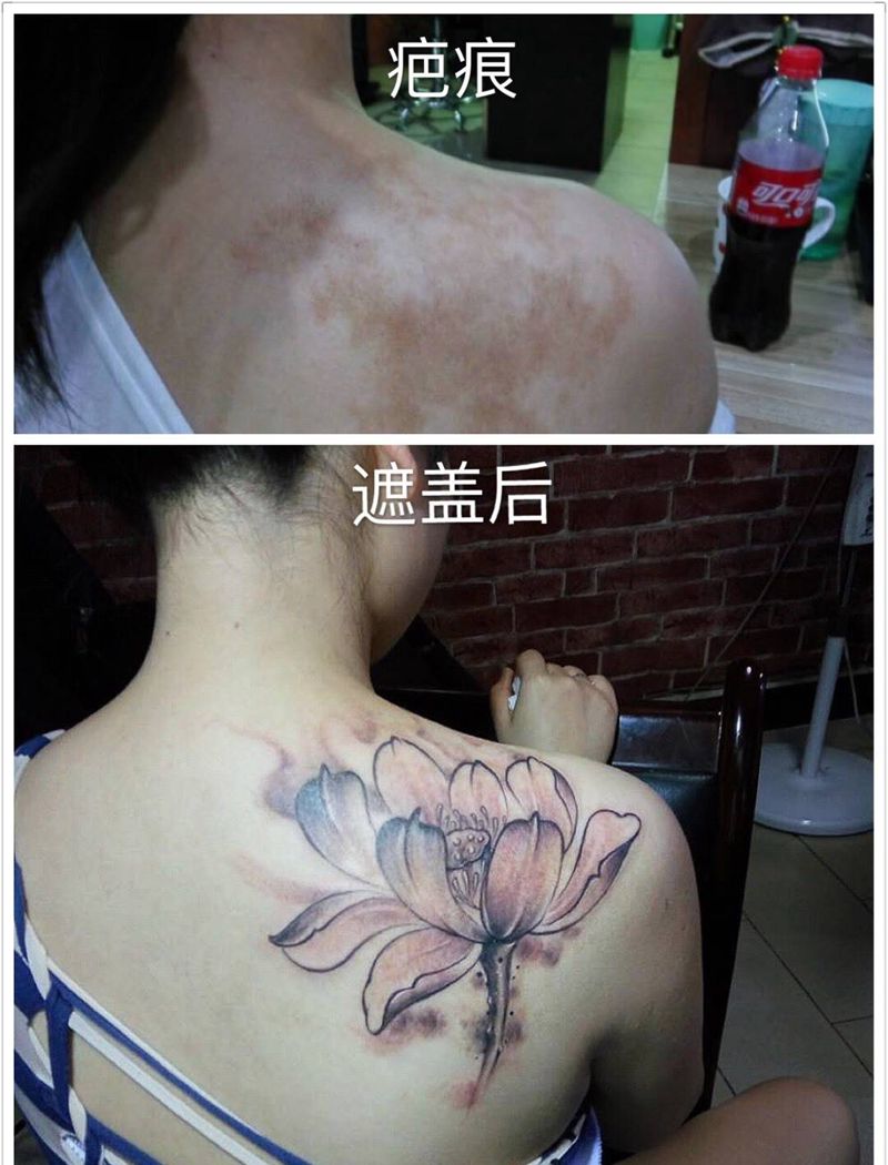 疤痕遮盖纹身图片