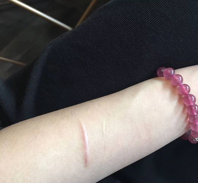 伤疤遮盖纹身图片_手臂铃铛纹身图案