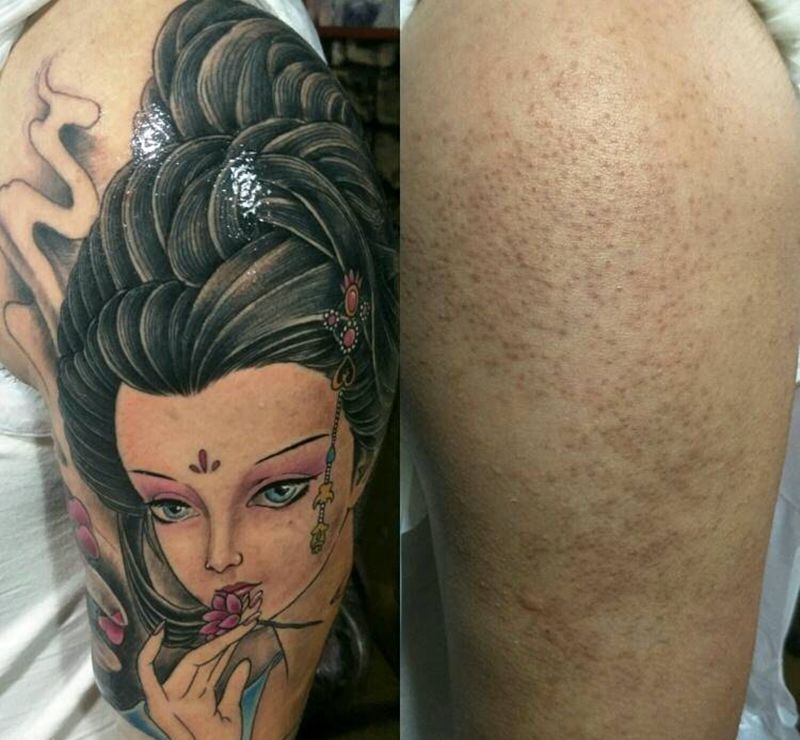 满脸疙瘩的女人纹身图片