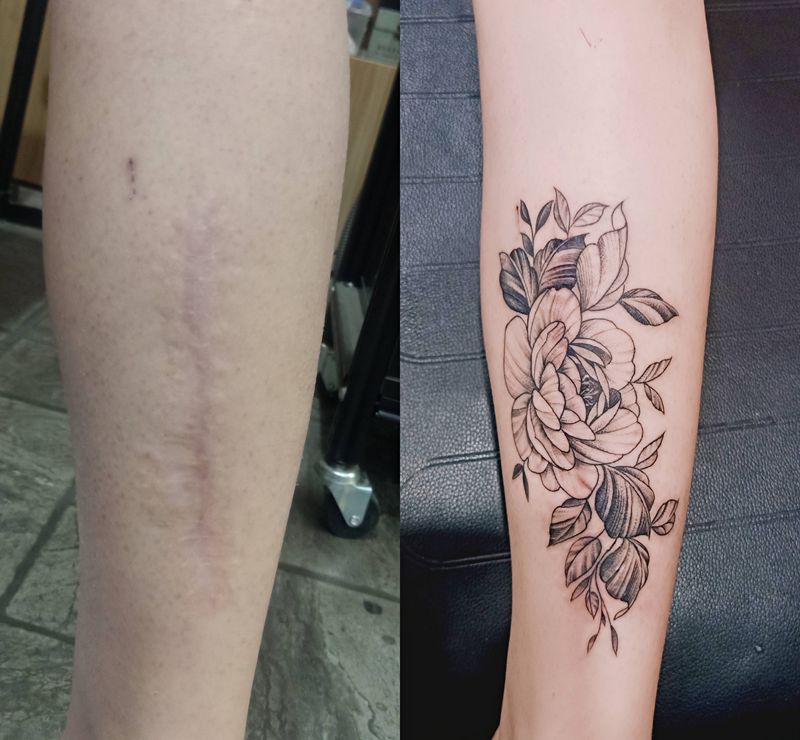 素花遮盖疤痕纹身图片_腿部纹身图案