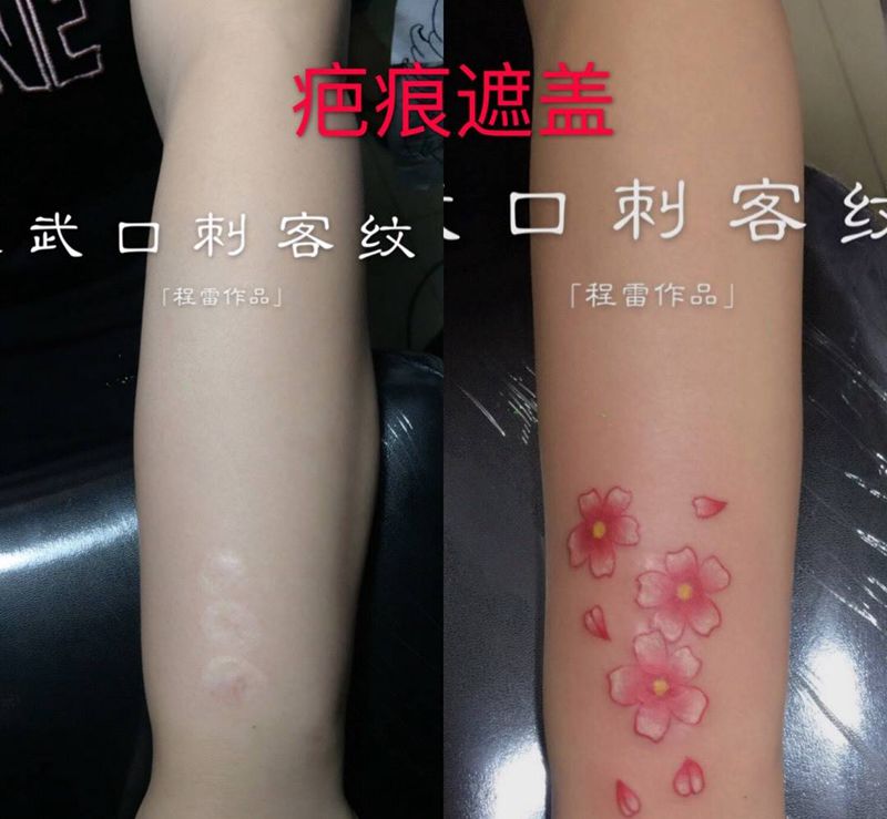 烟疤遮盖纹身图片