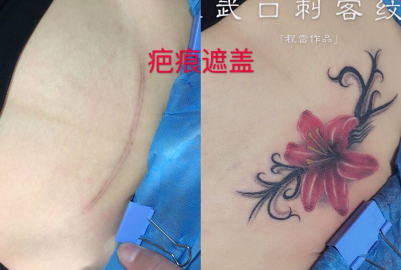 疤痕遮盖纹身图片_腹部纹身图案