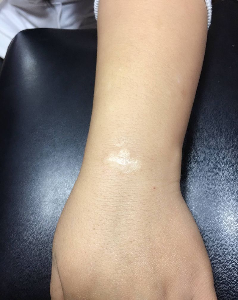 疤痕遮盖纹身图片_手臂纹身图案