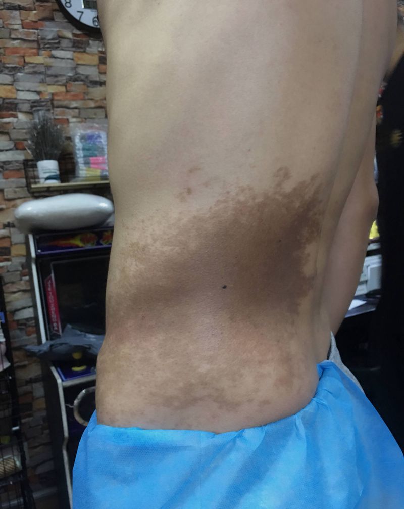 胎记遮盖纹身图片_腰部纹身图案