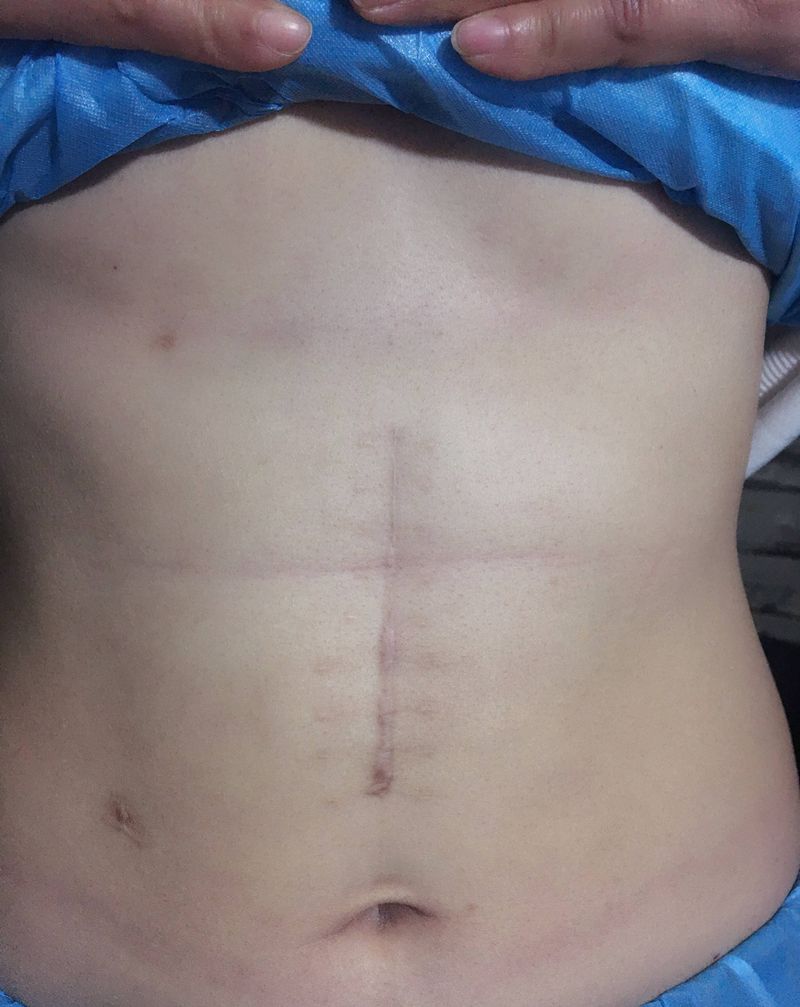 疤痕遮盖纹身图片