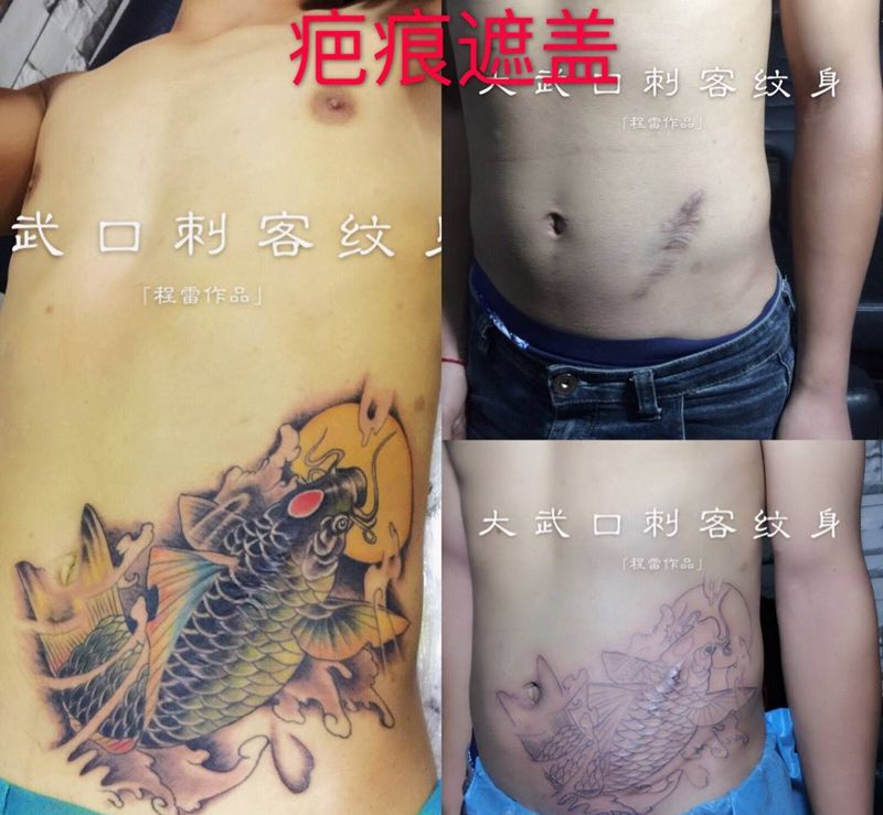 疤痕遮盖纹身图片