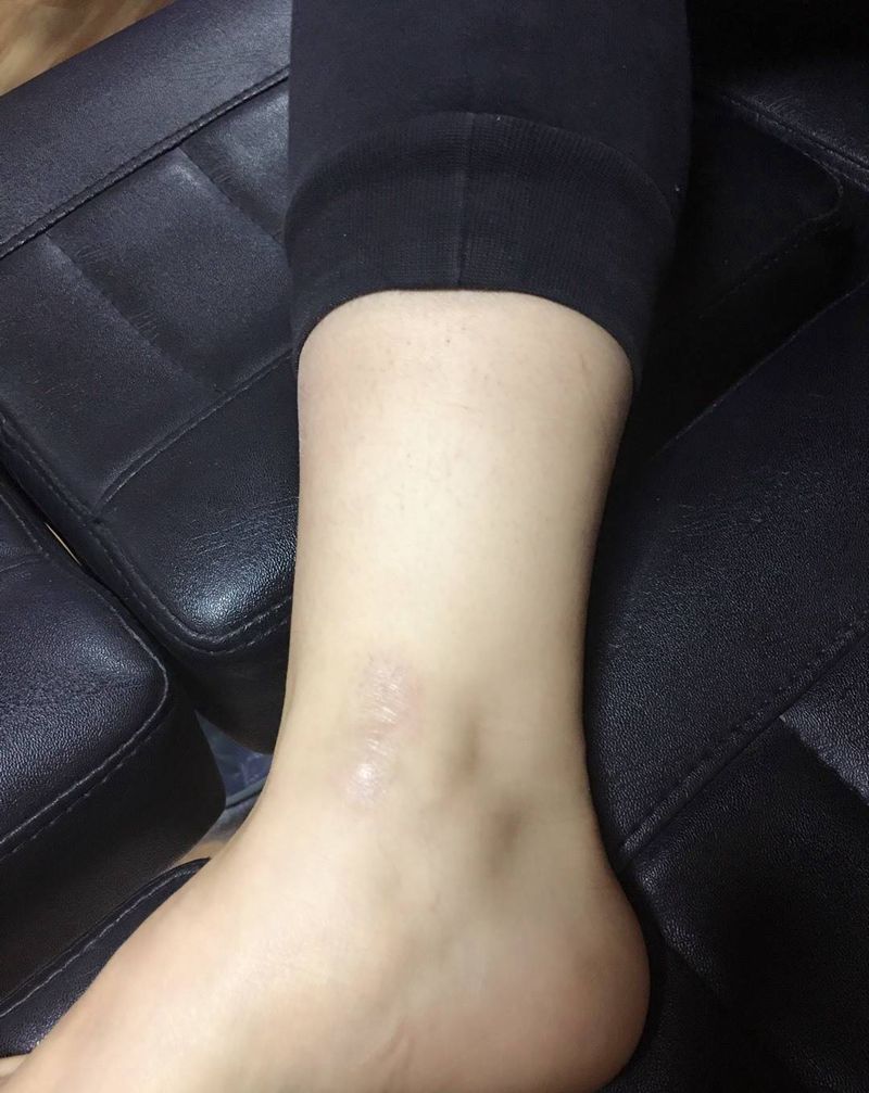 遮疤平安符纹身图片