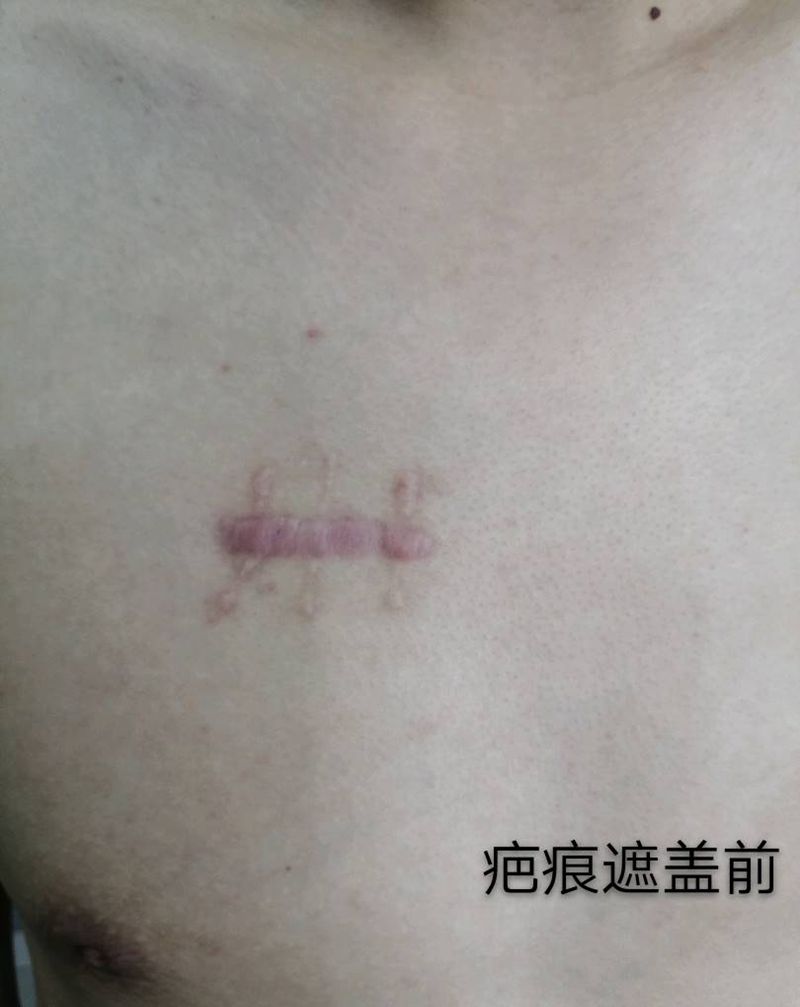 疤痕遮盖，彩色未完待续。纹身图片_胸部Old School纹身图案