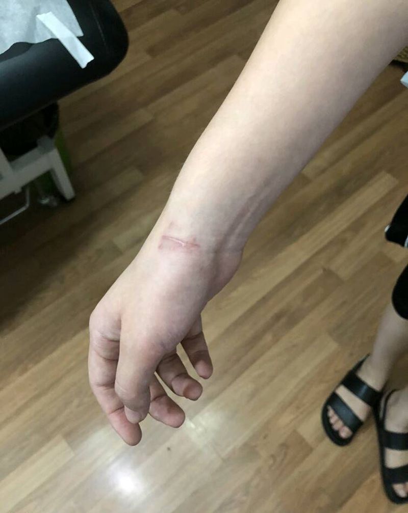 遮盖疤痕纹身图片_手部几何史迪仔纹身图案