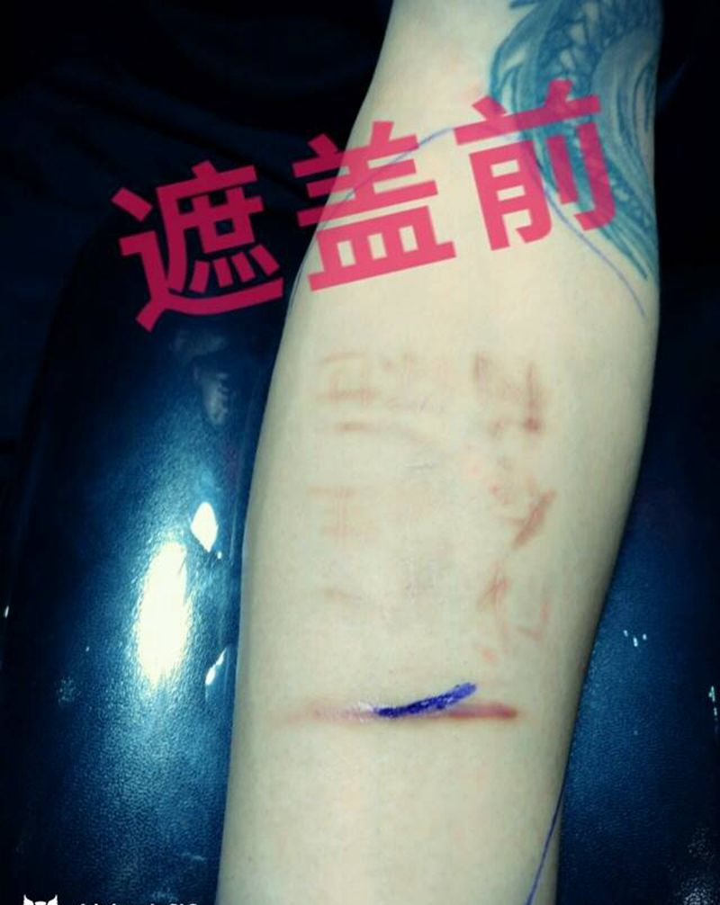 疤痕遮盖纹身图片_银川大唐纹身图案