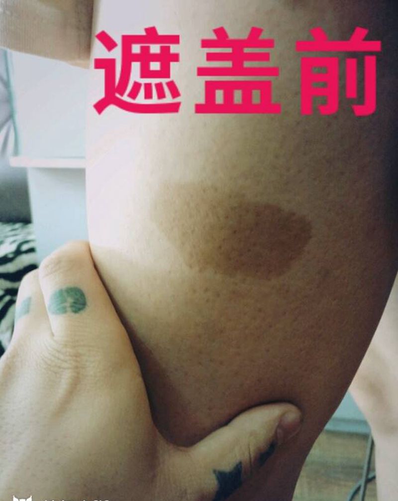 胎记遮盖纹身图片_银川大唐纹身图案