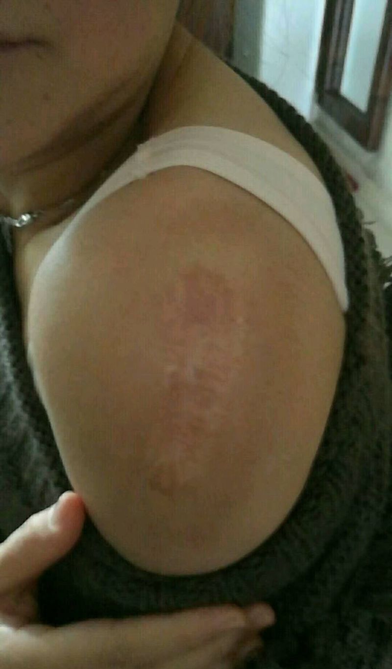 疤痕遮盖纹身图片