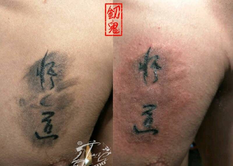 洗纹身，洗雾纹身图片