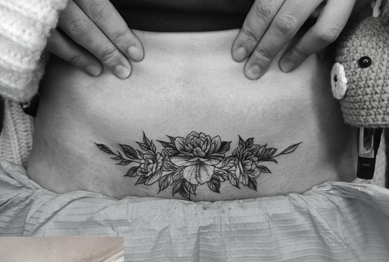 素花纹身图片_腹部点刺素花遮盖纹身图案