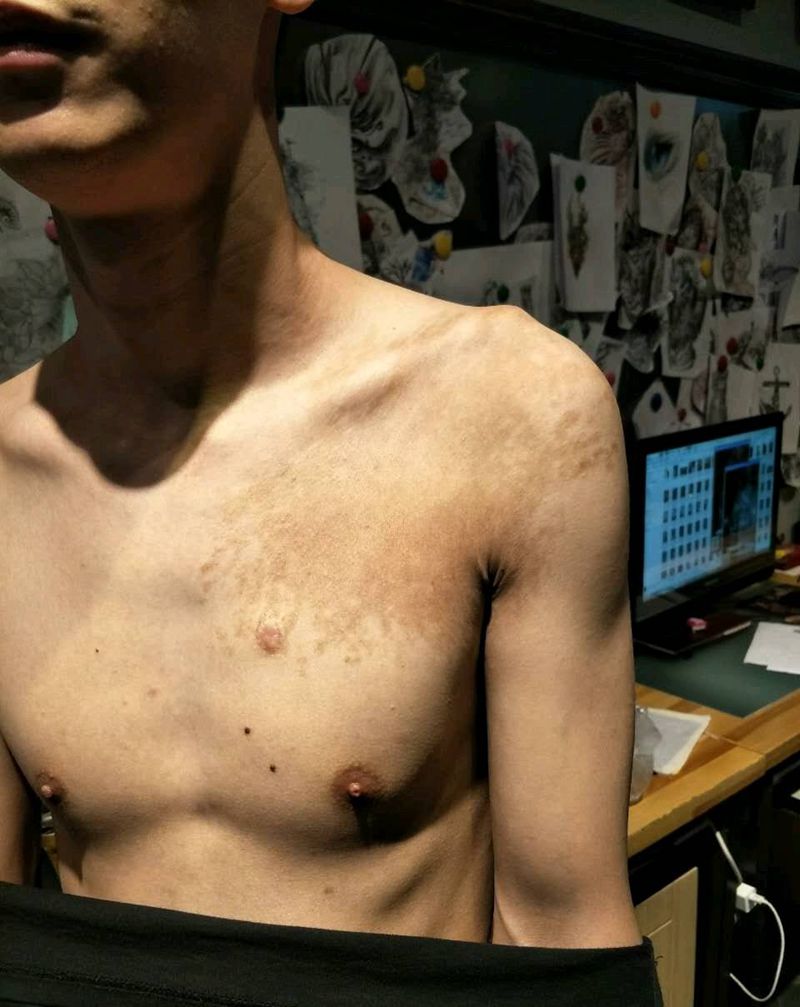 图腾遮盖胎记纹身纹身图片