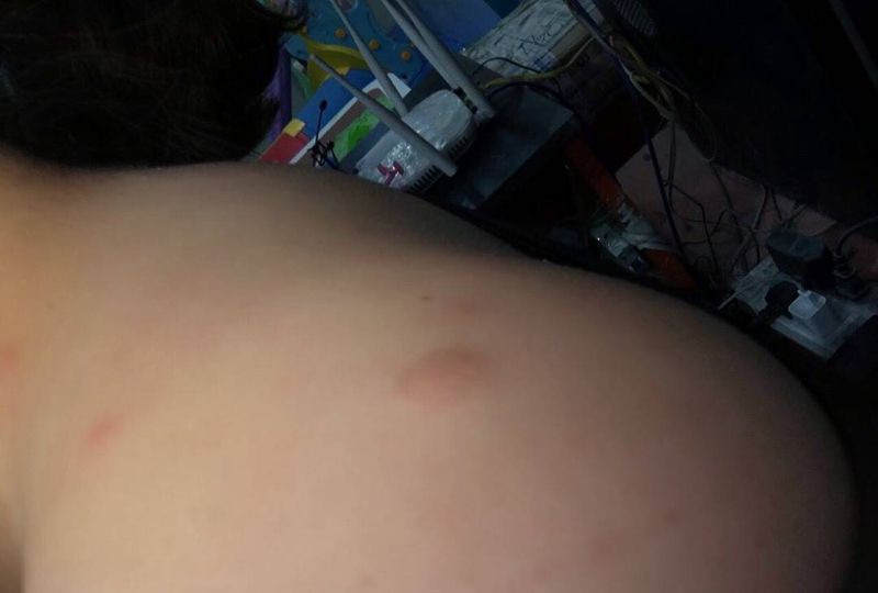 疤痕遮盖纹身图片_动物字符原创传统清新肩部成品纹身图案