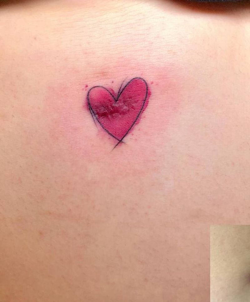 疤痕遮盖纹身图片_手臂纹身图案