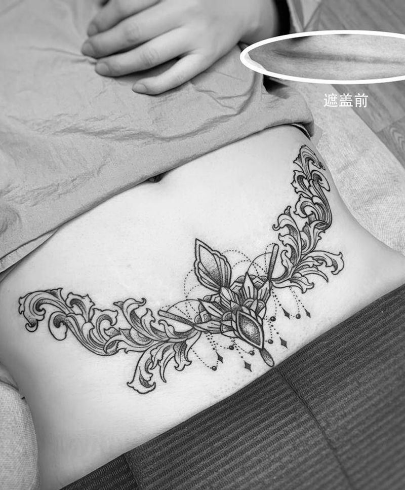剖腹产盖疤纹身图片_腹部腰部图腾点刺遮盖疤痕破腹产遮盖遮盖纹身图案