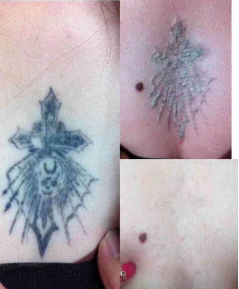 本店洗纹身案例纹身图片_洗纹身纹身图案