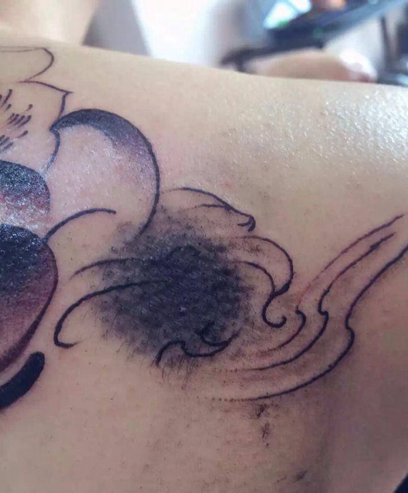 胎记覆盖纹身图片_